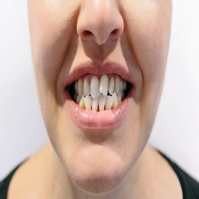 Unrecognizable woman mouth with dental crowding